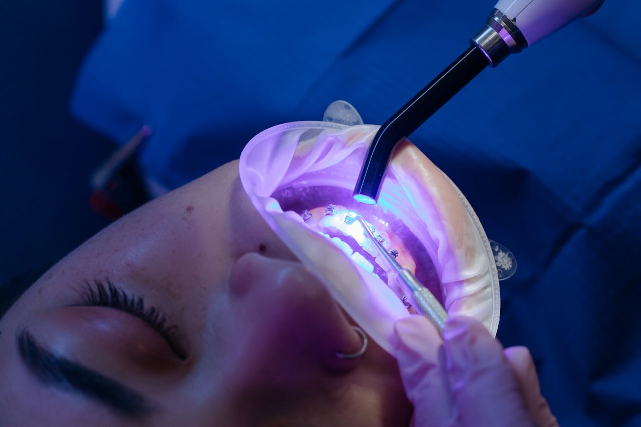 about-us-02 Close-up view of a dental procedure using LED curing light, enhancing oral health care.